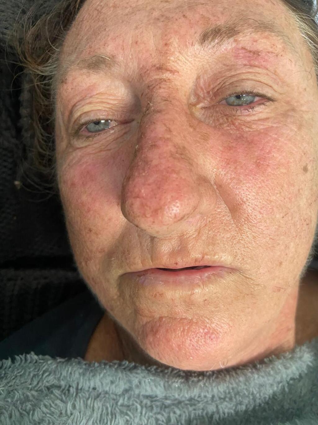 Saúde Municipal busca familiares de idosa localizada na SP-255